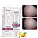 40G Remove Pregnancy Scars, Scars and Acne Treatments for Pregnancy