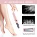 SQUADO - Professional Electric Pedicure Rechargeable Foot File Pedicure with 2 Spare Roller 2 Speed & LED Lights Foot Care Tools for Cracked Heels Calluses - Buy Online on GoSupps.com