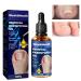 Ingrown Toenail Treatment Toenailplus Anti Paronychia Relief Oil Nail Helper Anti Paronychia Relief Oil Ingrowth Toenail Correction Treatment Oil Cuticle Nail Oil for Damaged Discolored Thick Nails