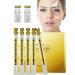 Stronrive 3 Facial Lifting Protein - Absorbable collagen protein thread for facial filling | Improves skin elasticity stretches the skinline