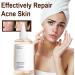 Glycolic Acid 7% Toning Resurfacing Solution Hydrating Toning Solution Skincare Hyaluronic Acid Serum Exfoliate Brighten Blemishes Acne and Rejuvenate Moisturize & Strengthen Your Skin 240ml - Buy Online on GoSupps.com