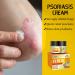 Natural Herbal Eczema Psoriasis Cream for Dry & Itchy Skin - Sensitive Skin Moisturizer - Anti-Itch Treatment - 0.7 oz - Pack of 1 - Buy Online on GoSupps.com