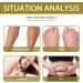  2 bags Foot Spa Soak Beads for Stress Relief Bee Bath Foot Soak for Hard Skin Healthy Feet Skincare Set for Women Bee venoms Slimming Bead Bags - Buy Online on GoSupps.com