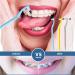 GWAWG 7PC Tooth Cleaning Eyering Kit Remove Stains Bleach & Care Tools for Oral Hygiene | International Shipping Available - Buy Online on GoSupps.com