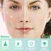 Star Pimple Patches for Acne - 240 Count Hydrocolloid Dots with Tea Tree Oil | 3 Sizes & 6 Colors - Buy Online on GoSupps.com