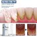Iunser Calculus Dissolving Spray - Portable Tooth Remover for Stain Removal | 30ml Red Algae Formula | Effective Teeth Cleaner for Home Use - Buy Online on GoSupps.com