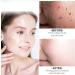 IZBEAUVO Vitamin C Face Exfoliator Gel Orange Face Scrub Exfoliator Vitamin C Exfoliating Face Scrub Acne Exfoliating Scrub Pore Facial Scrub Exfoliating Face Wash Remove Blackhead - Buy Online on GoSupps.com