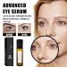 Time Eraser Rollerball with Castor Oil & Frankincense - Anti-Wrinkle Under Eye Serum (2 Pcs) | Reduce Fine Lines & Dark Circles - Buy Online on GoSupps.com