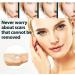 German Advanced Skin Renewal Gel Scar Gel For Acne Scars Stretch Mark Removal Cream Advanced Scar Treatment Natural Scar Therapeuti Gel Scar & Stretch Marks Remover Gel (3pcs) - Buy Online on GoSupps.com