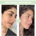 Panthenol Face Serum Niacinamide Serum Brightening Serum Hydrating Serum Korean Serum For Repair Dark Spot Corrector For Face Calming Serum Green Tea+Hyaluronic Acid Panthenol Cream - Buy Online on GoSupps.com