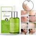 Goopgen Advanced Scar Repair Serum - Medical Grade Treatment for All Types of Scars - Buy Online on GoSupps.com
