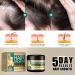Hocossy Hair Growth Cream Hair Growth Serum Hair Loss and Thinning Hair Treatment Moisturizing Scalp Massage Rejuvenate Follicles - Buy Online on GoSupps.com