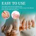 Fungal Nail Serum Pen with Tea Tree Oil and Aloe - Extra Strong Treatment for Toenails and Fingernails - Improve Damaged Nails - 1PCS - Buy Online on GoSupps.com