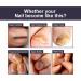 Nail Repair Oil Toe Nail Fungal Treatment Nail Fungus Treatment for Endophyt Nail Anti fungus Nail Repair and Strengthen Fix & Renew Damaged Broken Nails - Buy Online on GoSupps.com