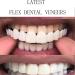 Giural Veneers Snap-In Teeth | Upper & Lower Artificial Dentures for Men & Women | Instant Cosmetic Smile & Tooth Whitening - Buy Online on GoSupps.com