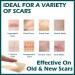 MIELIKKI Silicone Scar Sheets - Reusable 1.6x120 Roll for Scar Removal from Acne, C-Sections, Burns, and Surgery - Post Surgery Supplies - Buy Online on GoSupps.com