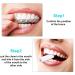 100 Aligner Chewies for Orthodontic Aligner Trays - White, Green, Orange, Pink & Purple - Buy Online on GoSupps.com