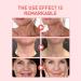 Anloximt Neck Moisturizer Hibiscus and Honey Neck Cream for Sagging and Tightening - 1.7 oz Neck Moisturizer Women's Neck Cream Anti-Aging Neck Cream - Buy Online on GoSupps.com