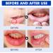 Spray Soulagement Douleurs Dentaires 30ml Spray Contre Maux de Dents Sprays R paration Gencives Sprays Soin des Maux de Dents - Buy Online on GoSupps.com