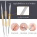 Pimple Popper Tool Kit - 6Pcs Blackhead Remover Comedone Extractor Set in Metal Case - Buy Online on GoSupps.com