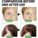 Castor Oil for Hair Growth Pure Naturals Cold Pressed Hair Growth Oil for Women Men Promote Hair Growth Strengthen Hair Roots and Prevent Bifurcation 60ML - Buy Online on GoSupps.com