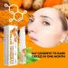 Turmeric Retinol Eye Stick - Hydrating Eye Balm for Dark Circles Wrinkles & Puffiness | Anti-Aging Eye Cream with Visible Results in 3-4 Weeks - Buy Online on GoSupps.com