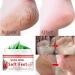 Moisturizing Foot Cream for Daily Use | Heal Cracked Heels & Dry Feet | Excess Callus Removal - Buy Online on GoSupps.com