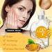 Protoence Dark Spot Remover for Face - 1 oz. Natural Turmeric Oil Facial Skin Care - Skin Care Face Oil Evens skin tone moisturizes dull and - Buy Online on GoSupps.com