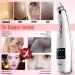 Blackhead Remover Vacuum Kit | Electric Pore Cleaner Tool with 6 Probes | USB Rechargeable & LED Display | Acne Suction Extractor for Men and Women - Buy Online on GoSupps.com