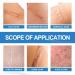 Gomice Scar | Scar Repair Gel for Stretch Marks | Scar Treatment for Surgical Scars Caesarean Sections Cuts & Burns Reduce - Buy Online on GoSupps.com