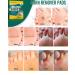 Max Strength Corn Remover Plaster - 24 Pads for Toes & Feet | Large & Small Sizes | Effective Corn Removal - Buy Online on GoSupps.com