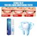 Teeth Whitening Pen - Speed Whitening Gel for Beautiful White Smile | Enamel Safe, Natural Mint Flavor | Painless & Travel-Friendly - Buy Online on GoSupps.com
