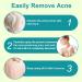 Skin Mist Soothes Irritation 120ml Liquid Against Blemishes Body Acne Spray Improves Skin Clarity For Women Men Youth Shoulder Arm Leg Ma - Buy Online on GoSupps.com