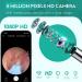 Oxbird 1080P Wireless Ear Wax Removal Kit with Camera - Smart Ear Cleaner for iPhone, iPad & Android - Black - Buy Online on GoSupps.com