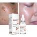 Glutathione Face Neck Skin Whitening Serum Freckle Dark Spots Removal Serum Glutathione Whitening Freckle Serum Moisturizing Vitamin C Essence Glutathione Whitening Face Serum - Buy Online on GoSupps.com
