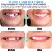 2 Sets of Comfort Fit Fake Braces & Instant Perfect Smile Veneers - Flexible Artificial Teeth for a Beautiful Smile - Buy Online on GoSupps.com
