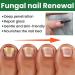 MrCuvaryas Nail Serum for Toenails Extra Strong - Buy Online on GoSupps.com