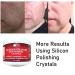 Clear Alka Vita Acne Scars Gel - Silicon & Collagen Crystals for Atrophic & Keloid Scars - 4.0 Fl Oz - Buy Online on GoSupps.com