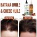 WOZUTUNT Huile de Batana pour la croissance et la sant des cheveux - Huile capillaire bio pour cheveux ab m s - Buy Online on GoSupps.com