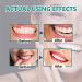  GNAUMORE Dentizen Drops Gum Regeneration Gel Regenerating Gum Gel Gum Regrowth Drops Gum Growth Drops Gum Regrowth Repair - Buy Online on GoSupps.com
