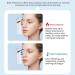 G n rateur De Vapeur Brume Pour Les Yeux Vaporisateur lectrique Hydratant - 3 Modes Hydratant Pour Les Yeux Pour Routine Quotidienne : Apr s Travail Voyage Maison Bureau D tente Matin et - Buy Online on GoSupps.com