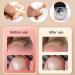 Ilamvie Ingrown Toenail Correction Set - 112 Piece C-Shaped Fill Padding Tool for Easy Ingrown Toenail Treatment - Buy Online on GoSupps.com