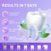 Purple Teeth Whitening Strips - V34 Color Correcting Sensitive Teeth Friendly 28 Strips for Men & Women - No Residue Whitening Kit for International Shipping - Buy Online on GoSupps.com
