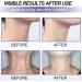 Neck Firming Cream Neck Tightening Cream Tighten and Lift Neck Cream Anti-Aging Neck Cream for Tightening and Wrinkles Advanced Tightening Moisturizer for Firm Retinol Moisturizer Cream for Women - Buy Online on GoSupps.com