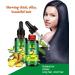  Kingknow Hair Growth Essential Oil Natural Ginger for Hair Loss Treatment Hair Growth Care Ginger Essential Oil Nourishing for Dry Damaged Hair Growth Care 30ml - Buy Online on GoSupps.com
