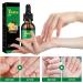 FLLUOUZH 3 PCS 7 Days Ginger Nail Ginger Nail Treatment Nail Support Nail Care Ginger Nail Growth Serum Ginger Cuticle Care Oil for Nails Nail Strengthener for Damaged Nails - Buy Online on GoSupps.com