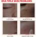 Glutathione Serum - Kojic Acid Serum for Skin Lig_htening - Dark Spot Correcting Glow Serum - Vitamin C Serum for Face - Hydrating Serum - Facial Serum for Even Skin Tone Moisturising (30ml) - Buy Online on GoSupps.com