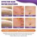 Silicone Scar Sheets & Tape | Effective Scar Removal for Surgical & Keloid Scars - 1.6 x 59 Roll (1.5M) - Fast International Shipping - Buy Online on GoSupps.com