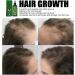 Hair Growth Serum Hair Lotion Hair Loss Treatments for Men Women Promotes Hair Thicker and Stronger Natural Nourishing Hair Growth Spray Hair Care for Dry Damaged Hair. (120ml) - Buy Online on GoSupps.com