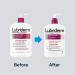 Lubriderm Advanced Therapy Moisturizing Lotion 24 fl. oz - Deep Hydration for Extra Dry Skin with Vitamins E and B5 - Non-Greasy Formula - Buy Online on GoSupps.com